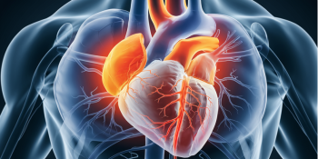 Miocardiopatia Dilatada: Orientações Cruciais para um Diagnóstico e Tratamento Adequados